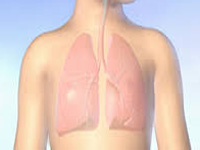 Pollution major contributor to asthma