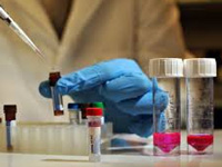 Health Dept asks for swine flu testing kits