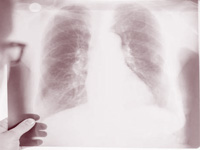 Even non-smokers can contract COPD