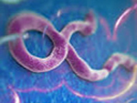 Vaccine trials to fight Ebola begin in US, UK & Mali