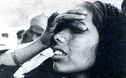 Justice remains mirage for Bhopal gas victims  