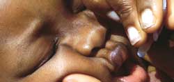 Namibia inoculates population post polio attack